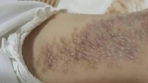 腋下长这种东西,很小就长了,6年级就有了,现在大概