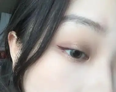 天生眼尾沟很漂亮啊 天生眼尾沟怎么形成的插图