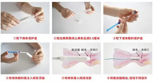 有效治疗九种高危型hpv病毒        3,同时治疗合并感染的妇科疾病