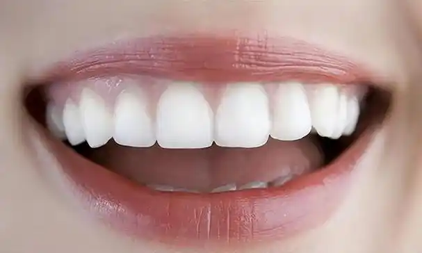 成年人还能矫正牙齿吗?正畸治疗需要多长时间?