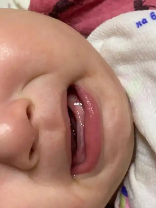 六个月宝宝出牙了么