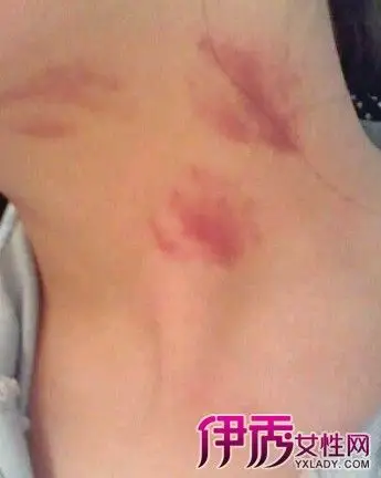 【图】关于种草莓的危害 解读其好处与坏处