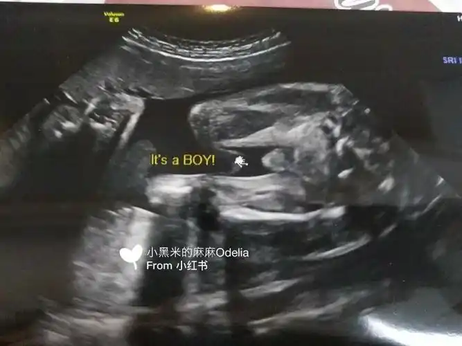 原来b超里男宝的小长这样-点开英国福利贴教你看b超