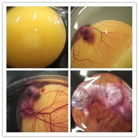 鸡蛋是人类最常吃的补品之一,所以我们很多人天天吃鸡蛋.你知道普通