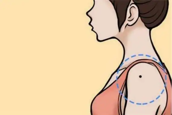 痣在左肩这样的女人结婚后会把重心放在丈夫身上,操持家庭,能够成为一