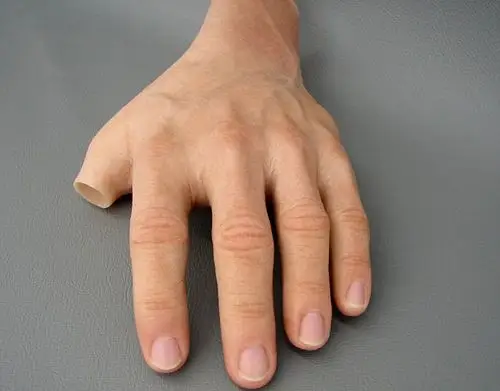 美容假肢手怎么样,该怎么选择