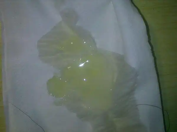 这个颜色是什么颜色 ?黄色?草绿色?,这样的精子质量正常么.