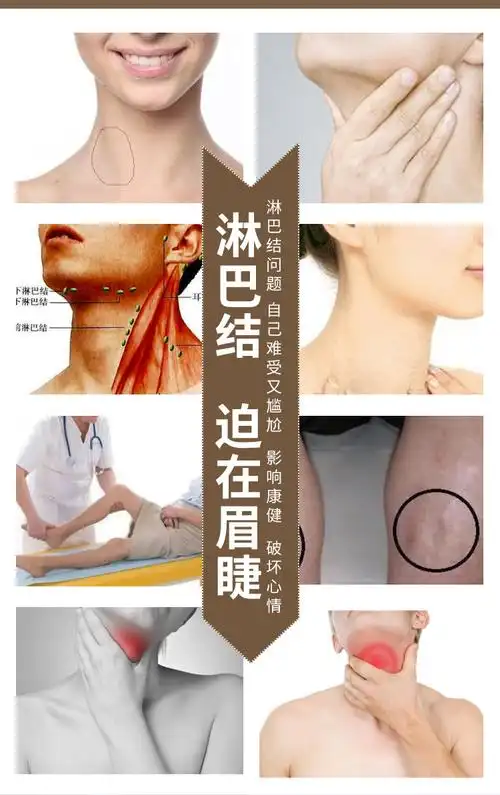 淋巴结消红花草本膏淋巴结消红花草本膏淋巴结肿大炎消贴颈部结节腋下