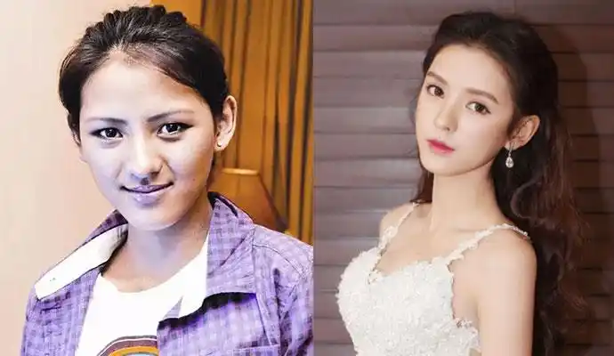 张予曦整容前后对比 终于知道王思聪为何与其分手了