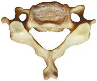 颈椎侧块指的是哪里?