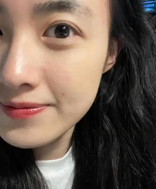 25岁容易长皱纹的几个地方:眼尾是重灾区,泪沟很多人不注重!