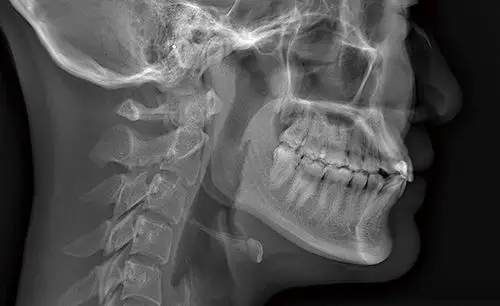 口腔ct头侧影像