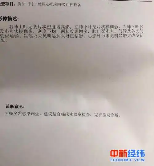 新冠肺炎康复者的24天没有咳嗽发烧我以为是小感冒