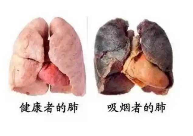 为什么长期吸烟的人,感受不到吸烟带给身体的伤害?听医生怎么说