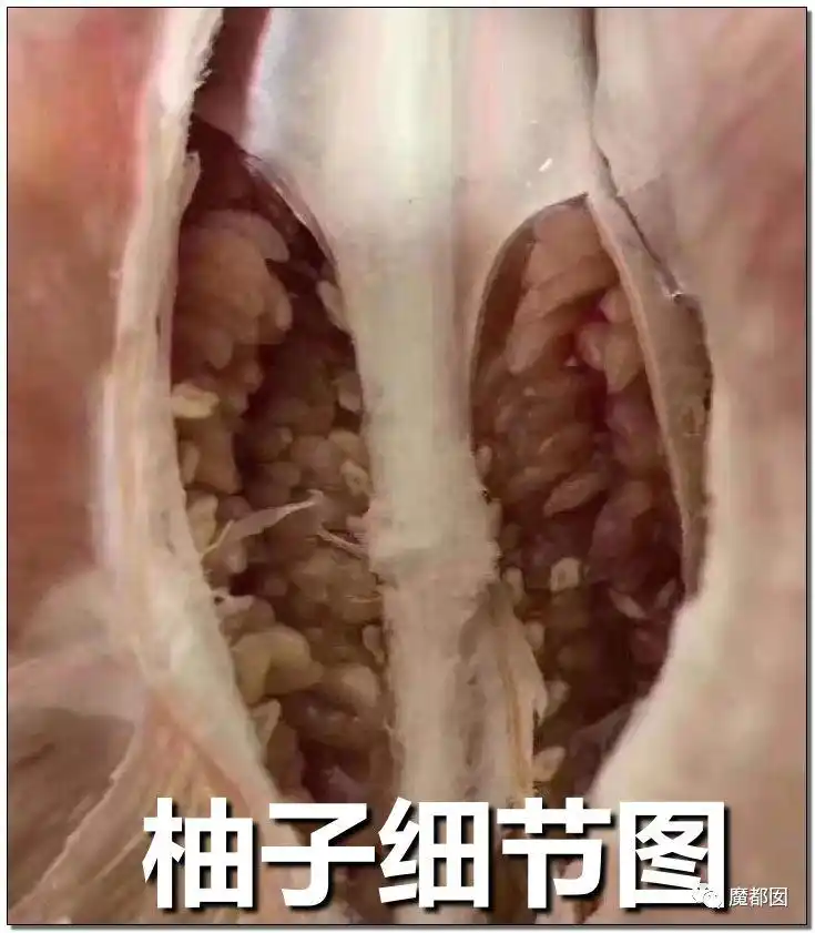 1118事件长蛆完整视频长蛆女子王思丽图片