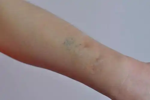 "我20岁就碰毒品了,是好奇让我染上了毒瘾.