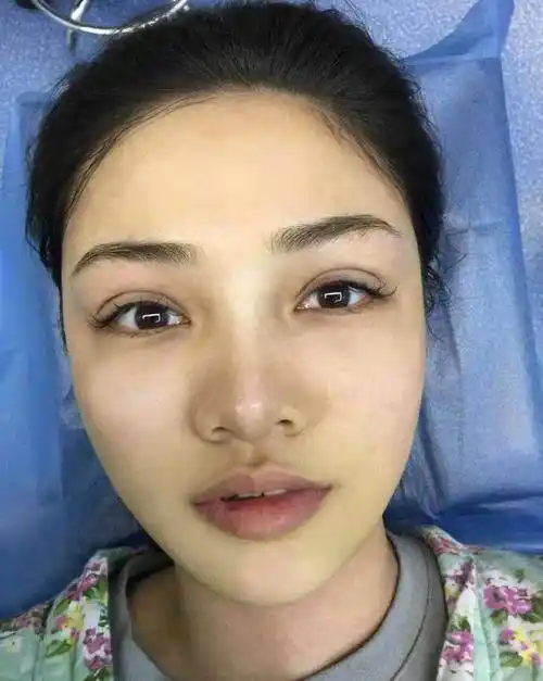 4种受欢迎的双眼皮形状,平行型公认最好看,平扇形颜值高,你呢_类型