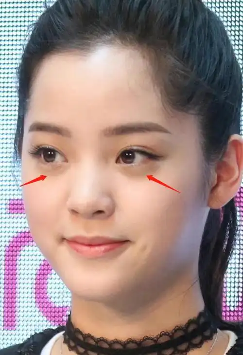 黑眼圈女生图片(黑眼圈女生图片可爱)-天晟网