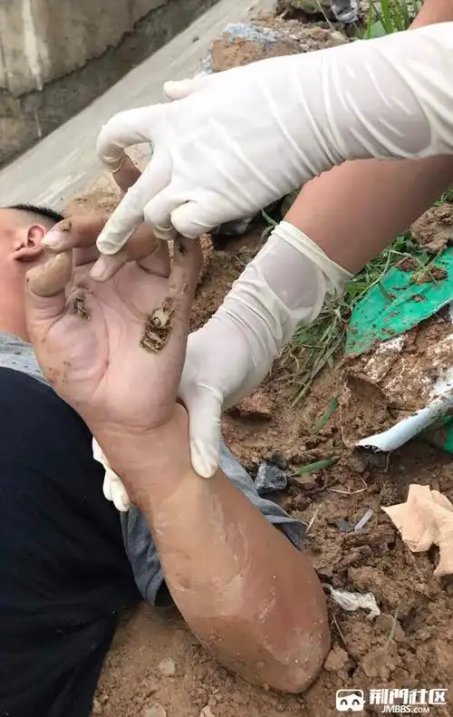 牌楼寨子坡今天上午有个人在这儿钓鱼被电死了有人知道什么情况吗