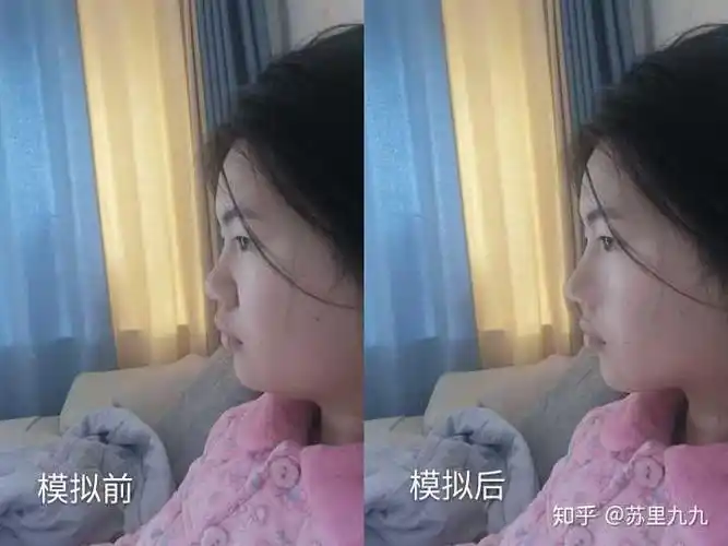 请问下我的这种侧脸该怎么改善呢?