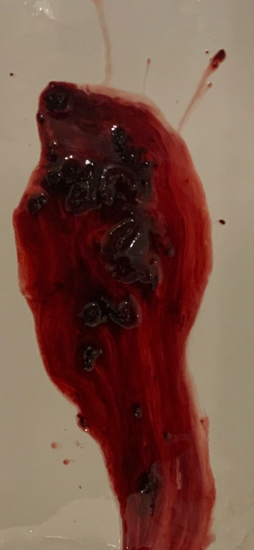 提前一天来姨妈,晚上肚子疼早上起来上厕所来很多血块.