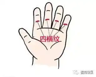 操作方法:操作者用拇指指尖,从宝宝的食指开始轻轻掐揉四横纹,掐1下