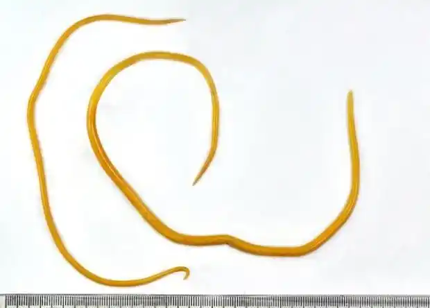 怎么判断人体该驱虫了,体内有蛔虫有什么表现!