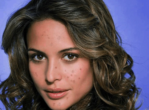 ps人像处理 photoshop人像的磨皮与美白 丑小鸭变成美丽的白天鹅 原图