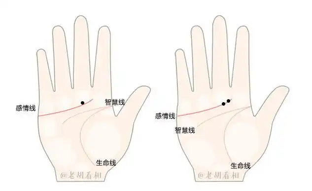 掌中有痣的人会有怎样的性格和命运