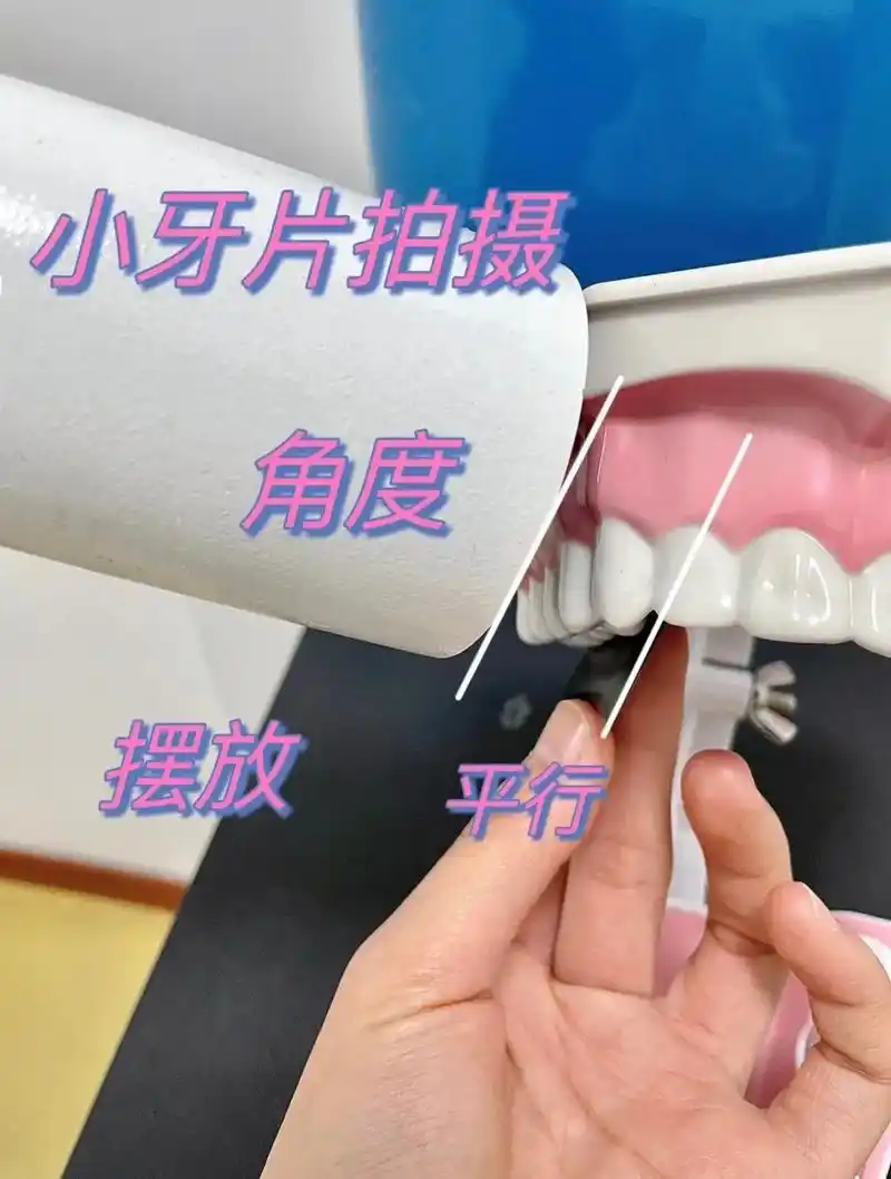 口腔护士操作流程第26615弹 小牙片.