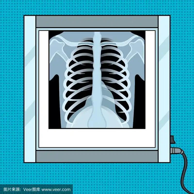 x光透视胸在阴性镜波普艺术