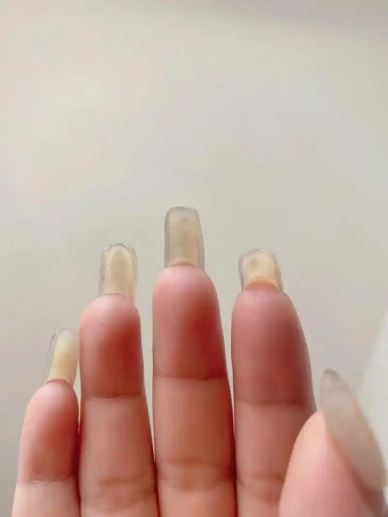 在线求问～ 中指指甲边缘裂开了 剪吗?只剪一个会不会奇怪04