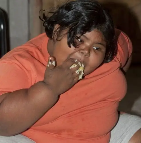 印度六岁女童体重达"180多斤"(组图)