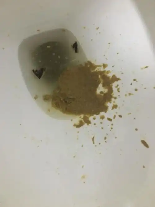 便便这么稀,每天5到6次上厕所经常放响屁,经常拉出来都是水