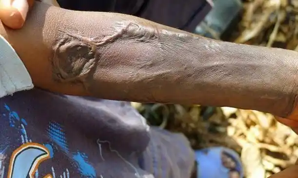 这个地方的儿童,经常被强行割掉器官当祭祀品,看了让不寒而栗