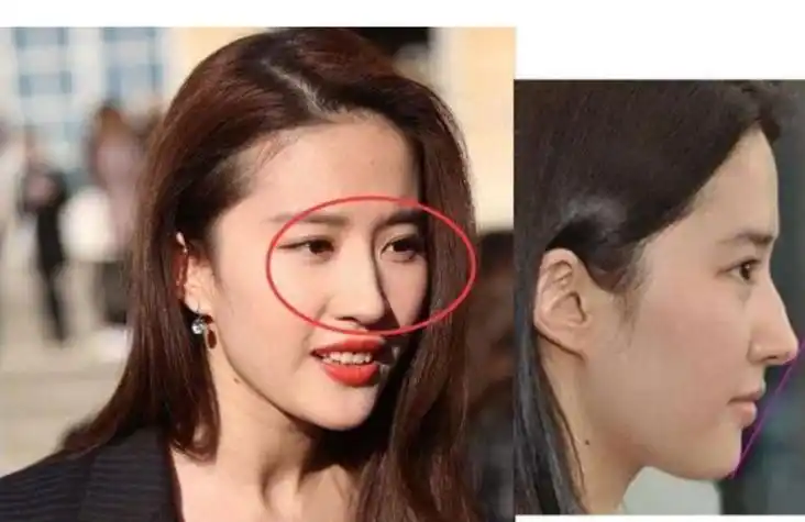 面相大师:鼻梁上有这个凸起的人,一生要离好几次婚,准的可怕!