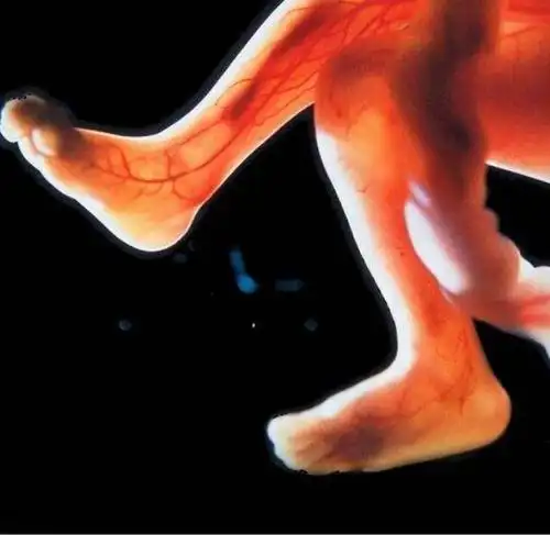 原创格格怀孕40周的宝宝是什么样子的听妇产科医生给你详细说说