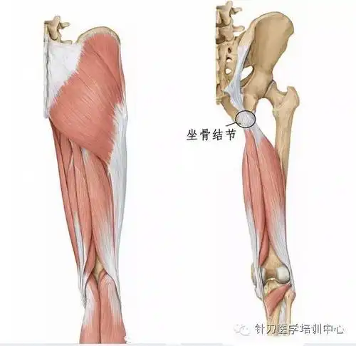 瑜伽损伤腘绳肌