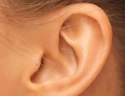 耳屏是耳朵的哪里