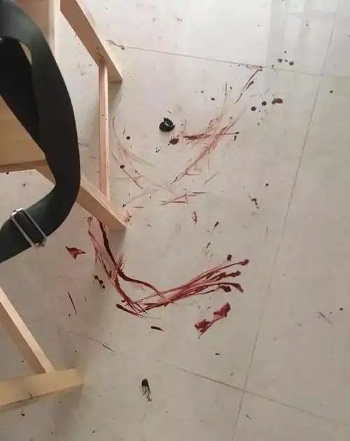 主人求助剃毛后猫咪疯狂咬自己尾巴