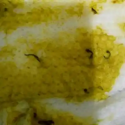 宝宝今天早上拉的便便里有黑色细长的东西,感觉像小虫子一样,长长