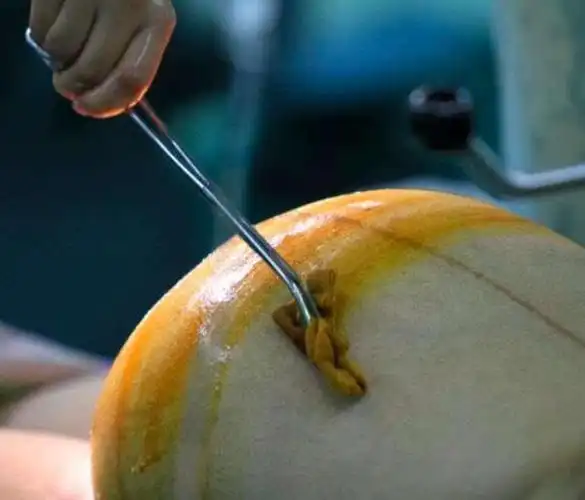 实拍剖腹产过程,剖开肚子,这一幕好温馨