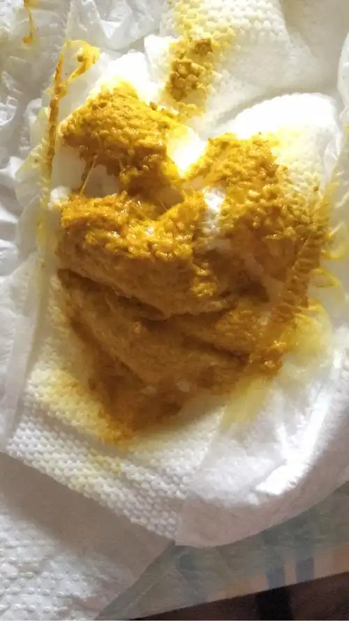 宝宝大便是不是消化不良,每天都要哭闹好久,好累啊,才28天