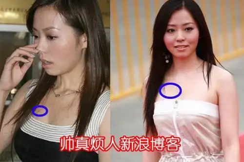娱乐圈胸有大痣的十大美女明星组图