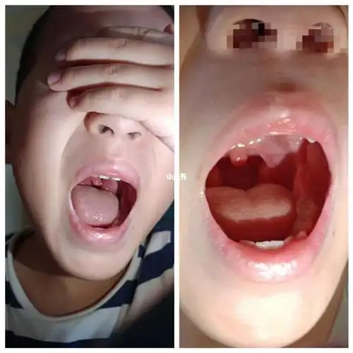 孩子的扁99体,终于保住了!