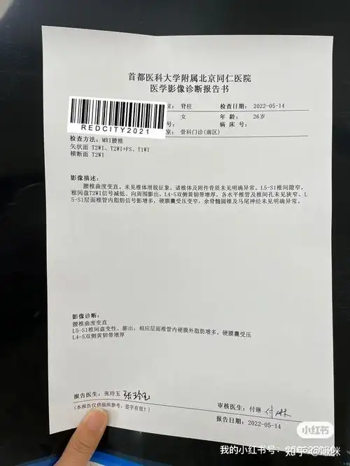 骶骨骨折第五个月