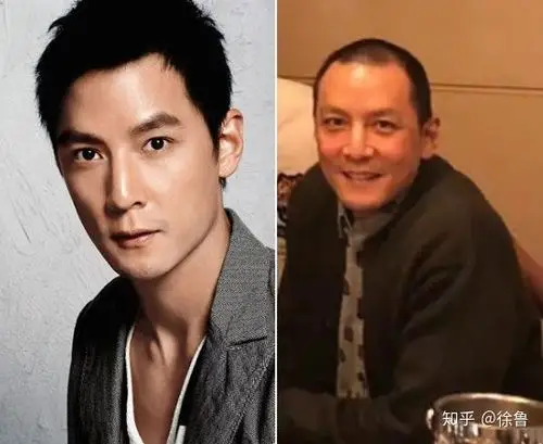 发际线太高怎么办?