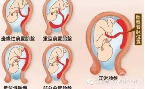 命中有几个孩子查询表头胎女