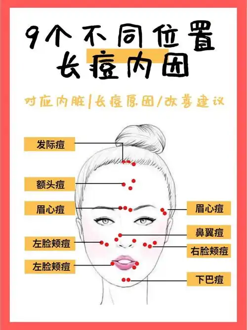 不同位置长痘内因和五脏六腑有关