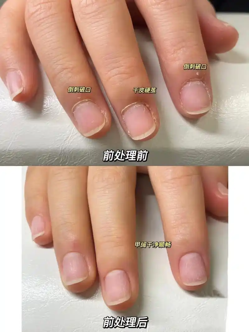 新中式前置处理 - 成都美甲!简单的介绍一下  新中式美 - 抖音